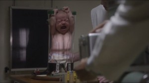 Fight- Doctors examine the Bombeck baby