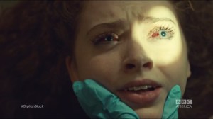 Scarred by Many Past Frustrations- Gracie is examined by the paramedics