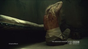 Scarred by Many Past Frustrations- Helena's scarred back