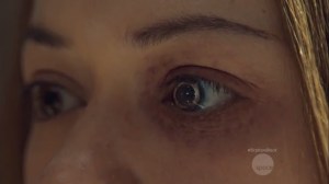 History Yet to be Written- Rachel's new eye