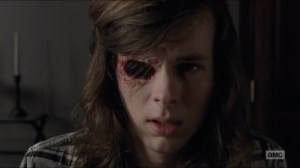 sing-me-a-song-carl-reveals-his-eye-socket