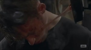 sing-me-a-song-marks-face-burned-by-the-iron