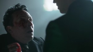 They Did What- Oswald asks Ed how his injured eye looks- Gotham, Fox